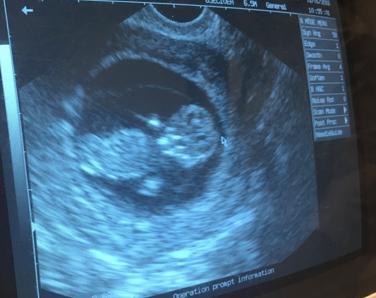 Screen Shot 2018-03-30 at 5.21.30 PM